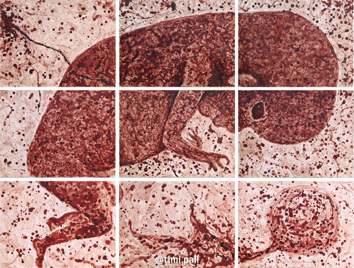 Pobreza menstrual: entenda os impactos sociais e ambientais do sangramento  - Revista Galileu