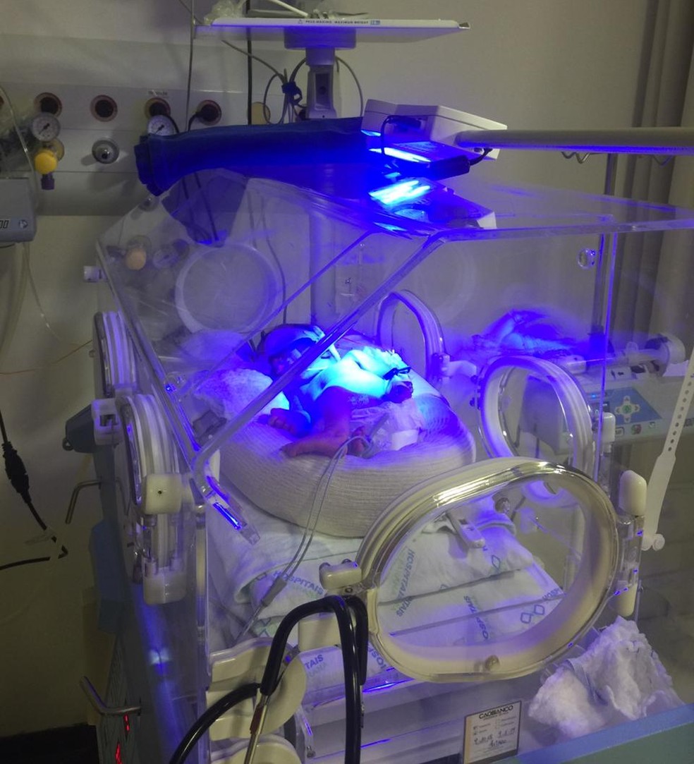 Rebeca nasceu de parto normal, com 2,07 kg e 42 centímetros, no Hospital Regional de Francisco Beltrão, e precisou ser internada na UTI neonatal — Foto: Michelli Arenza/RPC