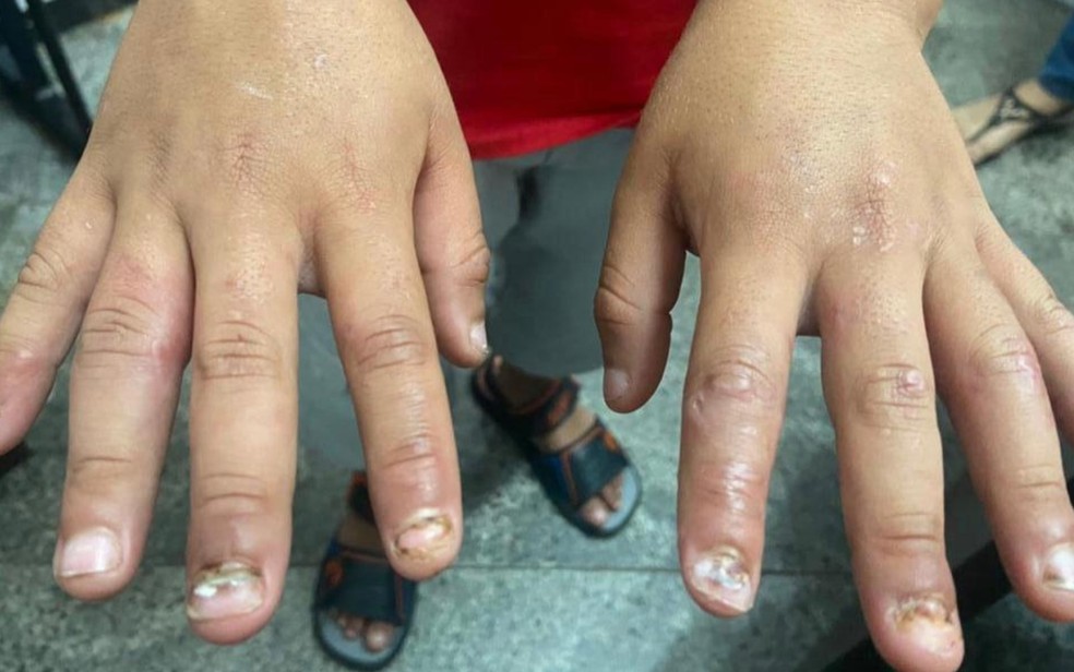 Menino de 8 anos foi torturado e teve unhas arrancadas — Foto: Divulgação/Polícia Civil