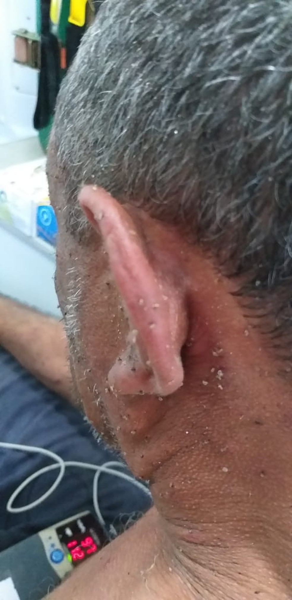 Homem foi medicado para interromper processo alérgico — Foto: Divulgação/Samu