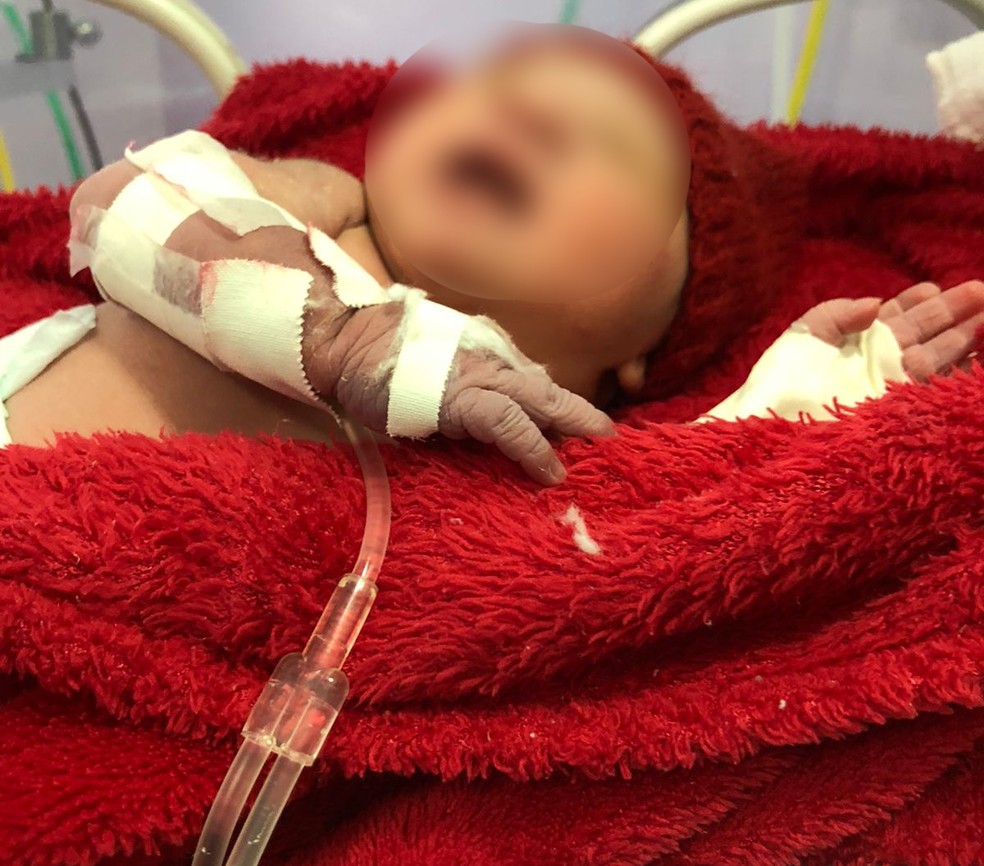 Após convulsão, jovem teve que passar por um parto de emergência — Foto: Arquivo Pessoal