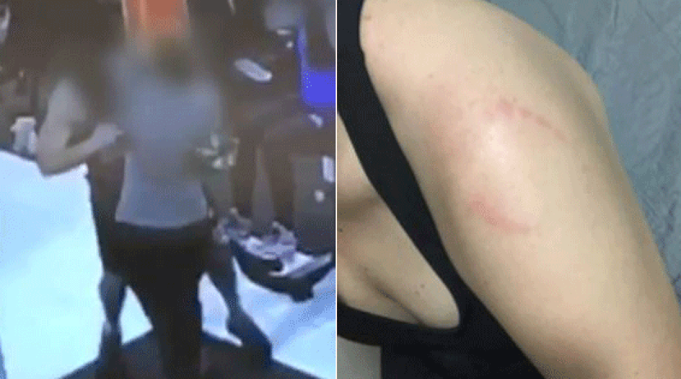 Homem morde mulher em academia — Foto: Reprodução