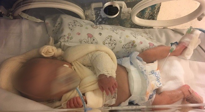 A bebê teve os dois braços quebrados em UTI de hospital em SP, segundo mãe (Foto: Arquivo pessoal)