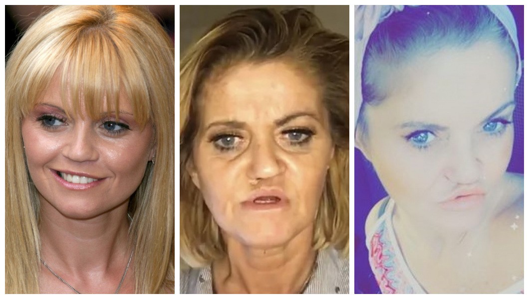 As transformações no rosto de Daniella Westbrook ao longo dos anos (Foto: Getty Images/Instagram)