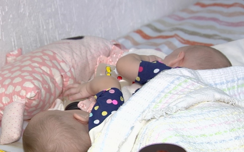 Eloá e Valentina, de 7 meses, nasceram unidades pelo abdome e esperam cirurgia de separação — Foto: Reprodução/TV Anhanguera
