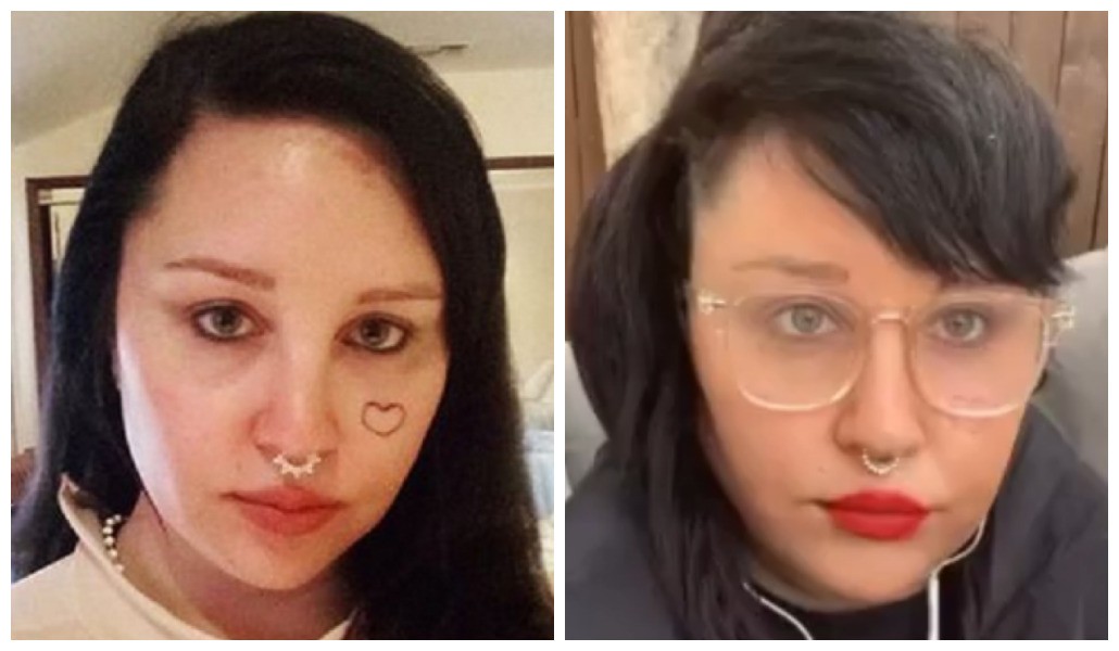 A atriz Amanda Bynes antes e depois da remoção da tatuagem de seu rosto (Foto: Instagram)