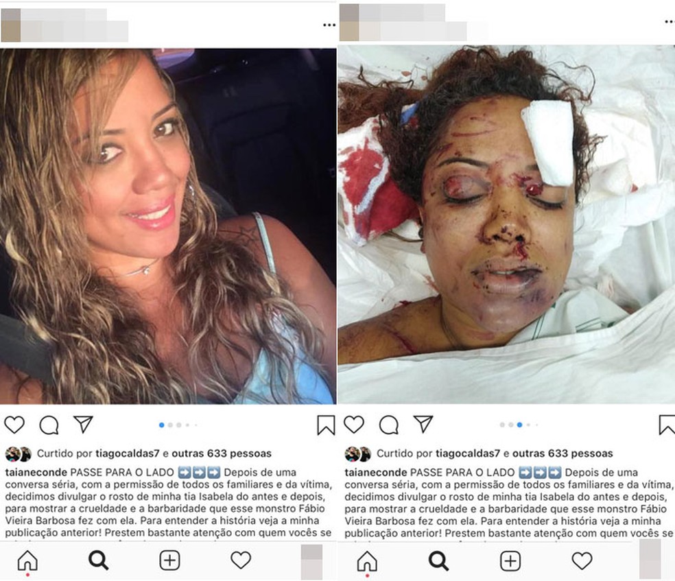 Rosto de Isabela ficou desfigurado após ela ser agredida a mando do namorado na Bahia — Foto: Reprodução/Redes Sociais