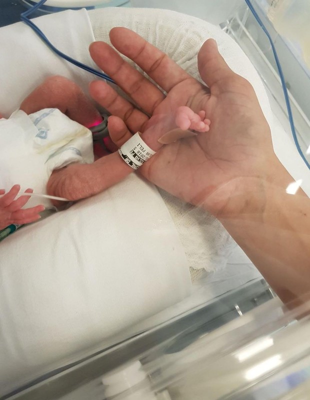 José, um dos gêmeos de Daniel Saullo e Mariana Felício, internado após parto prematuro, em 2018 (Foto: Reprodução/Instagram)