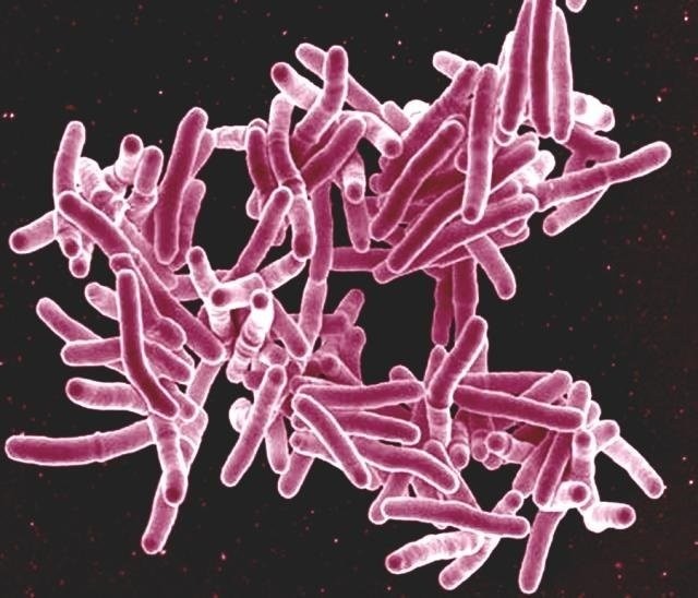 Mycobacterium tuberculosis (Foto: NIAID)
