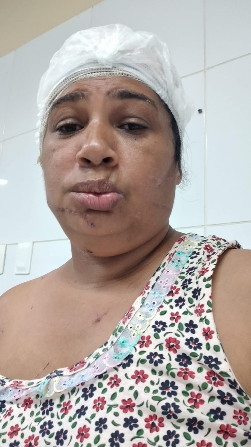 Guilhermina internada em hospital após a tentativa de feminicídio — Foto: Arquivo Pessoal