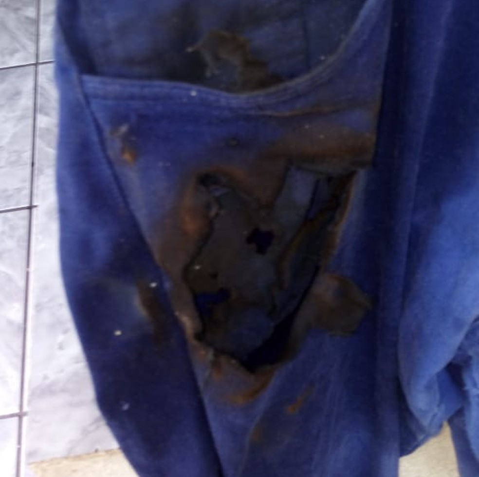 CalÃ§a de enfermeiro de AraÃ§atuba (SP) queimou apÃ³s celular explodir no bolso (Foto: AntÃ´nio Carlos da Silva dos Santos/Arquivo Pessoal)