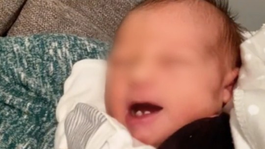 Vídeo de bebê recém-nascido com dentes viraliza e mãe comenta: ‘Enfermeiros ficaram em choque’ 