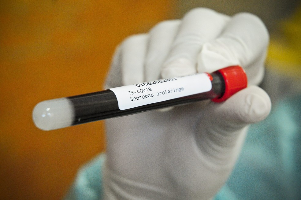 Teste para novo coronavírus— Foto: Breno Esaki/Agência Saúde