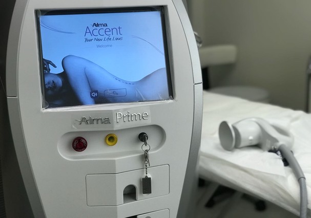 Alma Prime (Foto: Divulgação) Alma Prime (Foto: Divulgação)