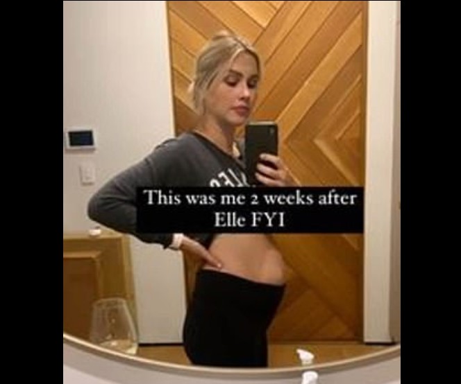 A foto compartilhada pela atriz Claire Holt, mostrando sua barriga duas semanas após ao nascimento da filha, em resposta à selfie de Emily Ratajkowski (Foto: Instagram)