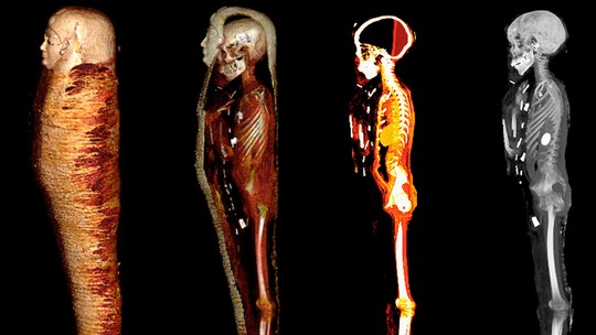 49 amuletos são encontrados com múmia de adolescente morto há 2,3 mil anos