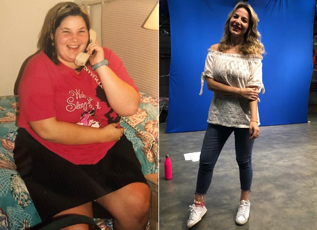 Luiza Zveiter: antes e depois da cirurgia bariátrica (Foto: Reprodução/Instagram)