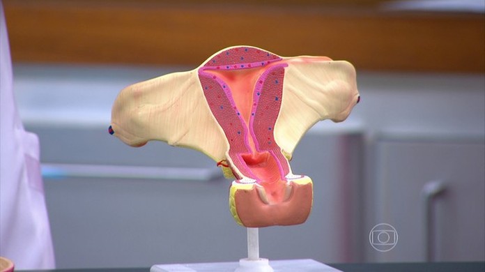 Mioma No Utero E Sinal De Cancer Bem Estar G1
