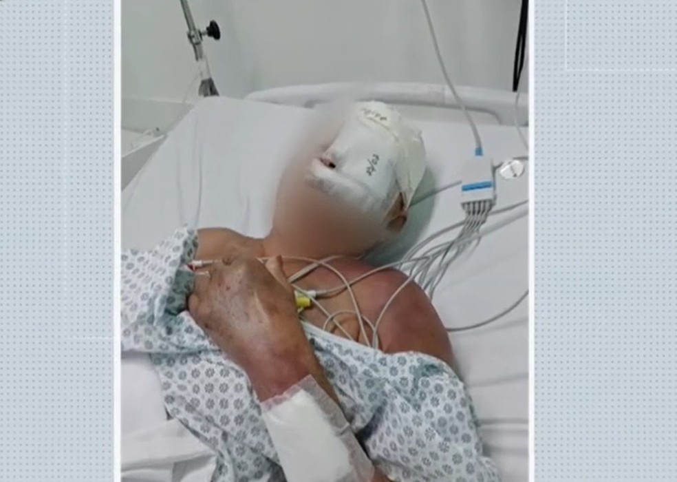 Idosa tem todos os dentes quebrados após ser agredida a pauladas na Bahia — Foto: Reprodução/TV Bahia