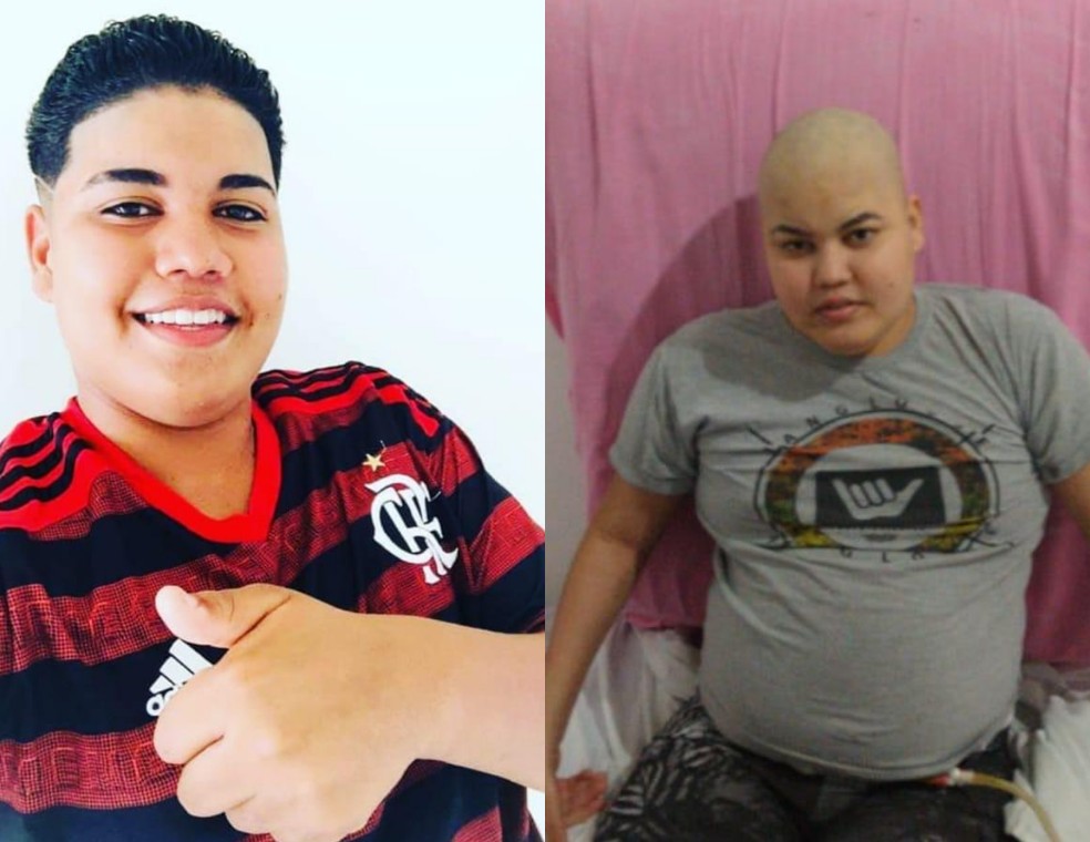 Izaquiel antes e depois da descoberta do tumor — Foto: Arquivo Pessoal