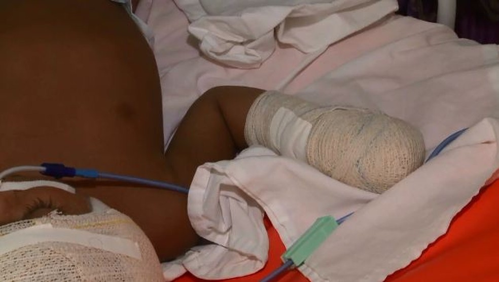 Bebê saiu da UTi e está no leito no hospital de Rio Branco  (Foto: Reprodução/Rede Amazônica Acre)