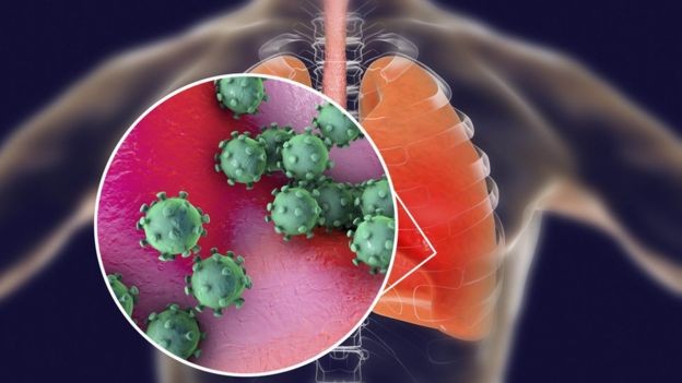 BBC - O coronavírus causa doença pulmonar grave (Foto: Getty Images via BBC)