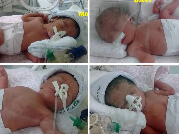 Quadrigêmeos nasceram em hospital de Cuiabá (Foto: Arquivo pessoal)