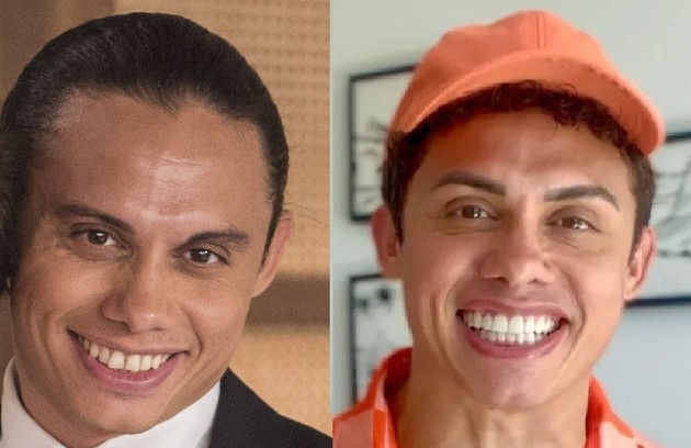 Silvero Pereira aplicou lentes nos dentes, aderiu ao botox e fez sobrancelha definitiva (Foto: Globo e Reprodução)