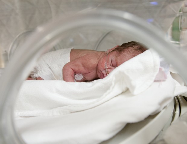 Bebê prematuro  (Foto: Getty Images)