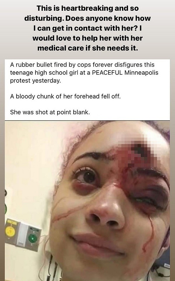 Post em que Kim Kardashian falou sobre manifestante atingida por bala de borracha em protesto (Foto: Instagram)