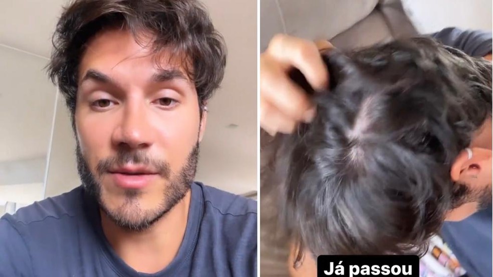 Eliezer revela ter sofrido grave queda de cabelo por conta de haters  — Foto: Reprodução/Instagram
