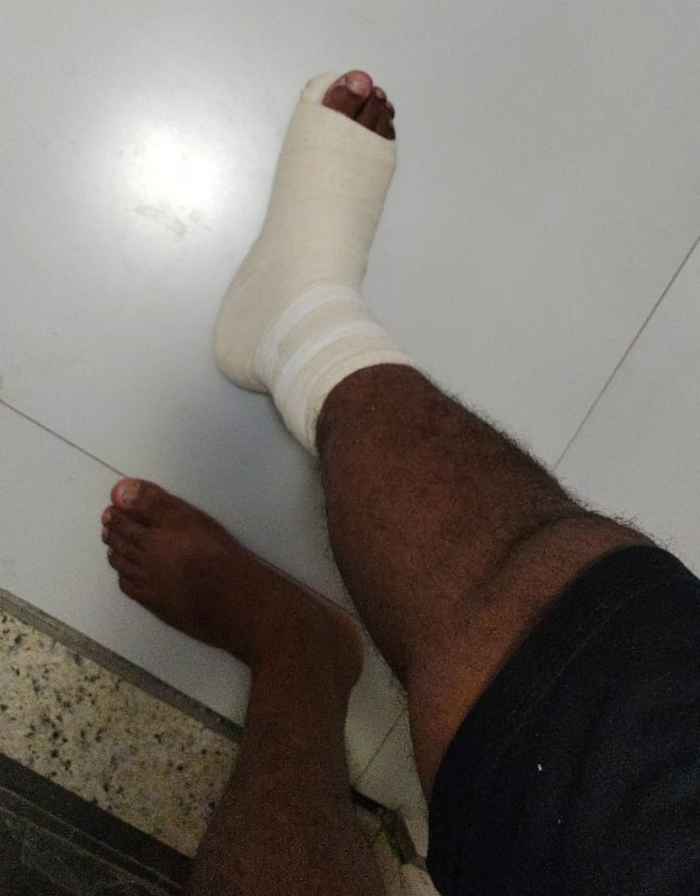 Paulo Arifa sofreu uma torção no pé direito após empurrão em shopping — Foto: Arquivo pessoal