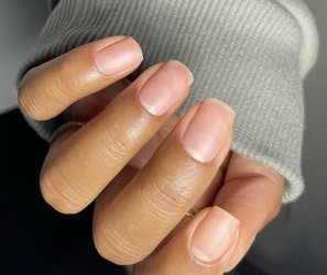 Manicure saudável: saiba como evitar unhas quebradiças e manchadas