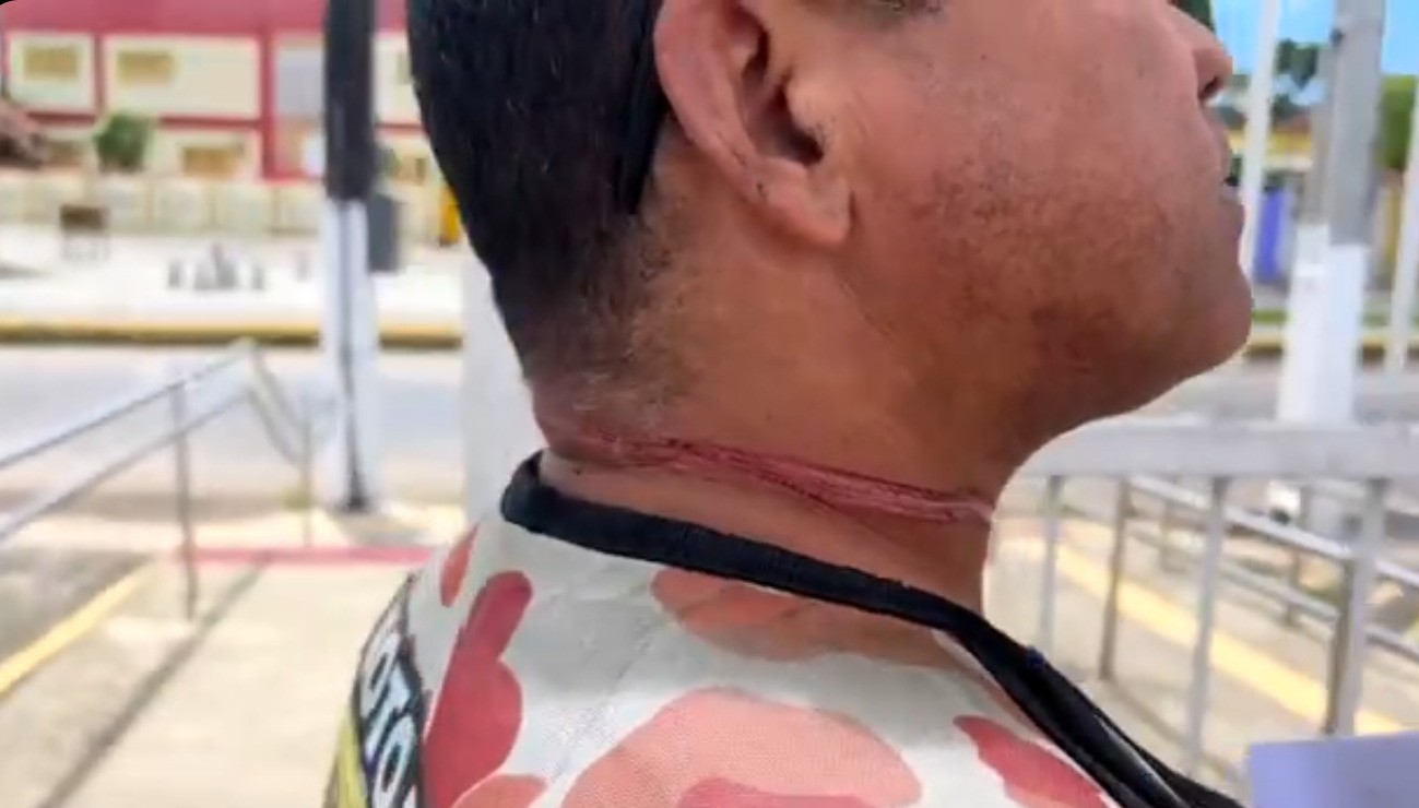 VÍDEO: motociclista se enrosca em fio e fica ferido no pescoço em Marechal Deodoro, AL