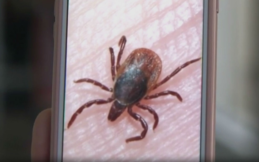 Febre maculosa é transmitida pelo carrapato-estrela (Foto: Reprodução/TV Subaé)