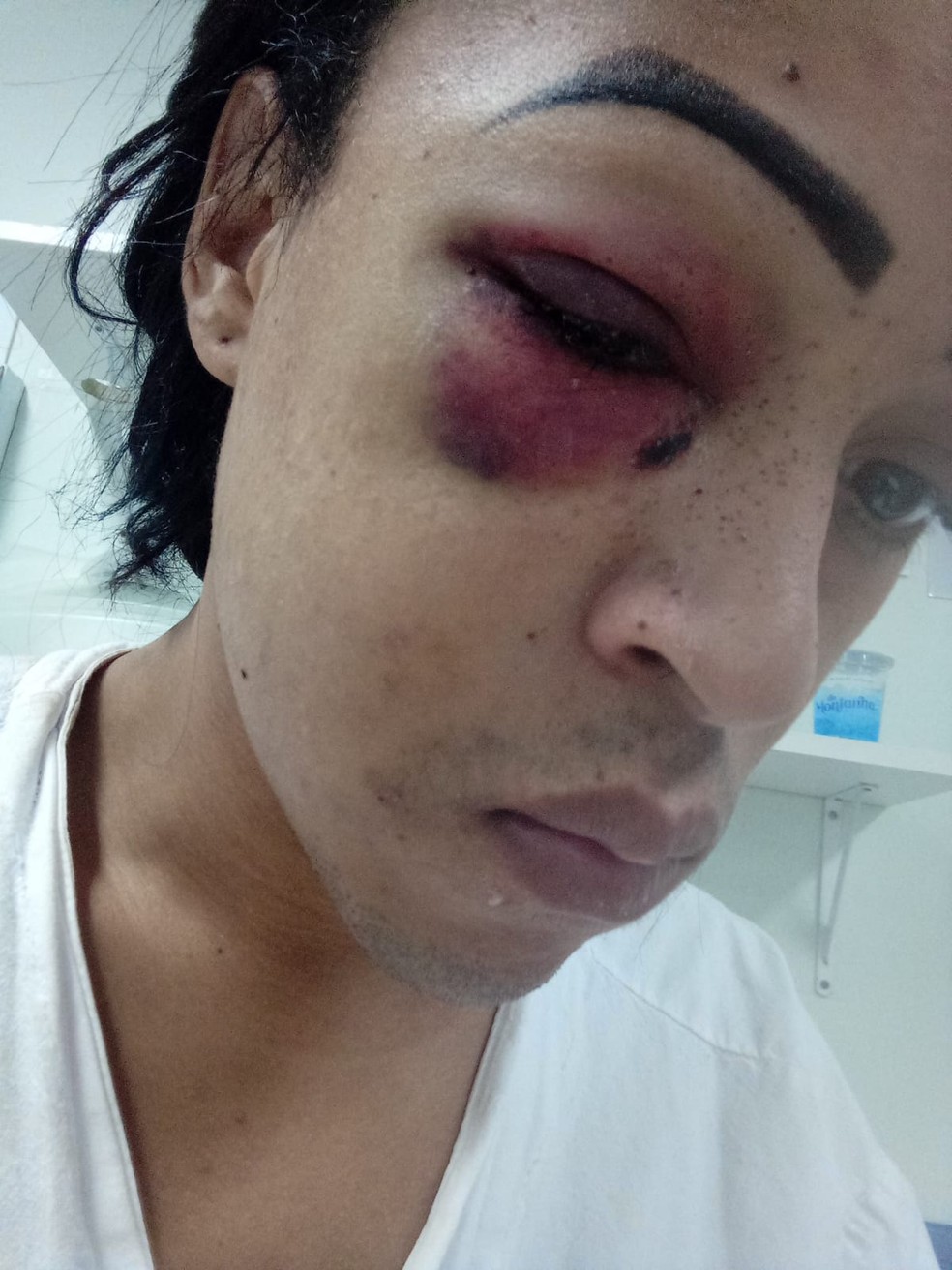 Vítima horas após ser atacada — Foto: Arquivo pessoal 