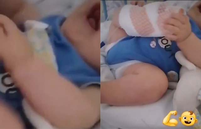 Bebê sem rosto passa por cirurgia (Foto: Reprodução/Instagram)