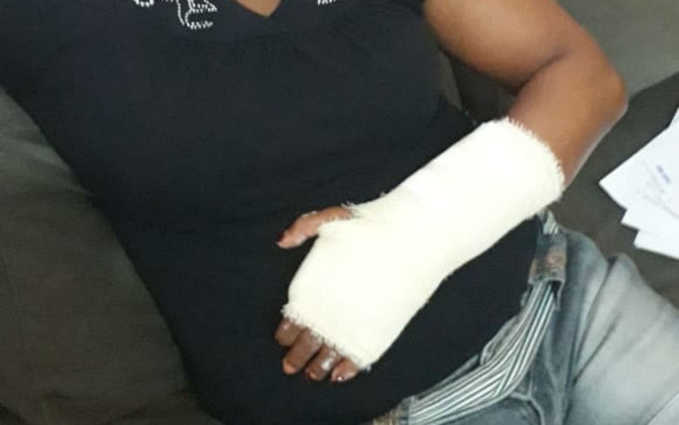 Mãe de Alisson teve a mão enfaixada após ser agredida por policiais na Bahia — Foto: Arte G1