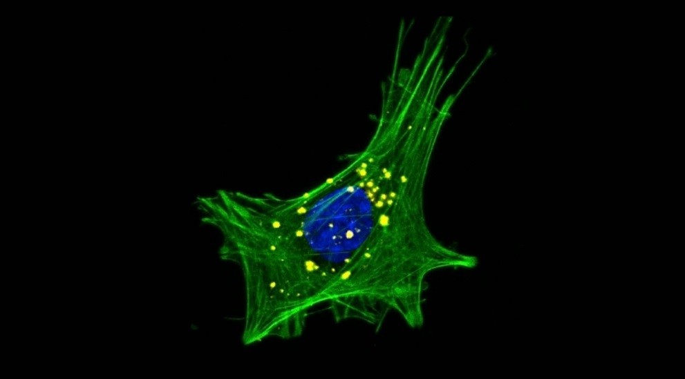 Agregados de ɑ-sinucleína em células intestinais. A imagem de microscopia confocal mostra uma célula enteroendócrina, com núcleo celular em azul, citoesqueleto de actina marcado em verde e agregados citoplasmáticos da proteína ɑ-sinucleína (Foto: Matheus de Castro Fonseca/CNPEM)