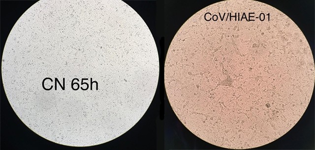 À esquerda uma célula humana não infectada; à direita, o coronavírus multiplicando-se em célula cultivada em laboratório (Foto: Divulgação/ICB-USP)