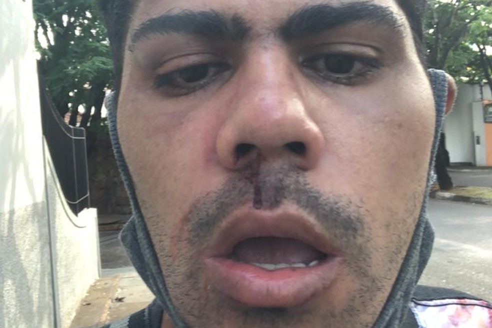 Vítima alega ter sido agredida em um banheiro público do Parque do Povo  — Foto: Rafael Gomes