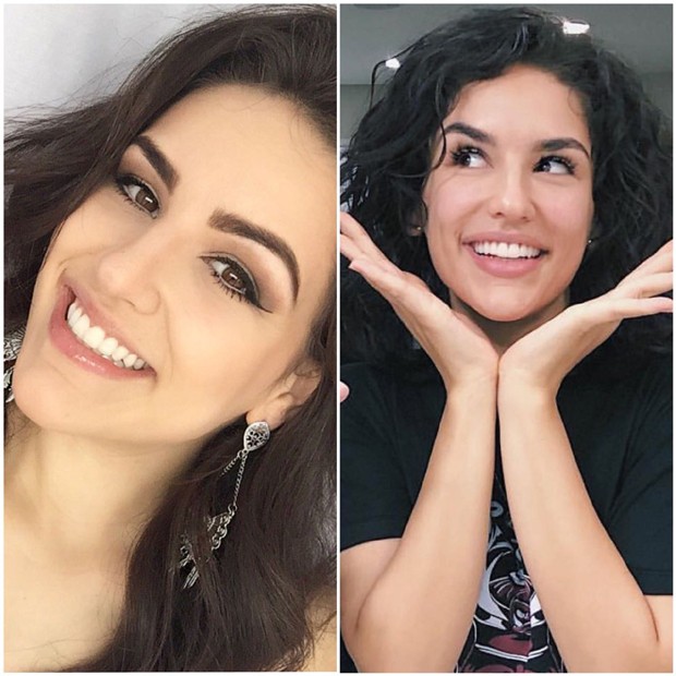 O antes e o depois dos dentes de Kéfera (Foto: Reprodução/Instagram)