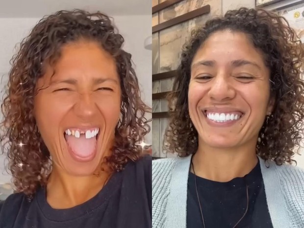 Antes e depois de Cris Rozeira (Foto: Reprodução/Instagram)