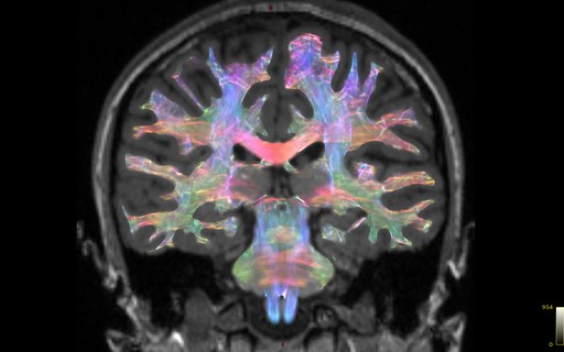 Vacina da Novavax apresenta 90% de eficácia contra Covid ...