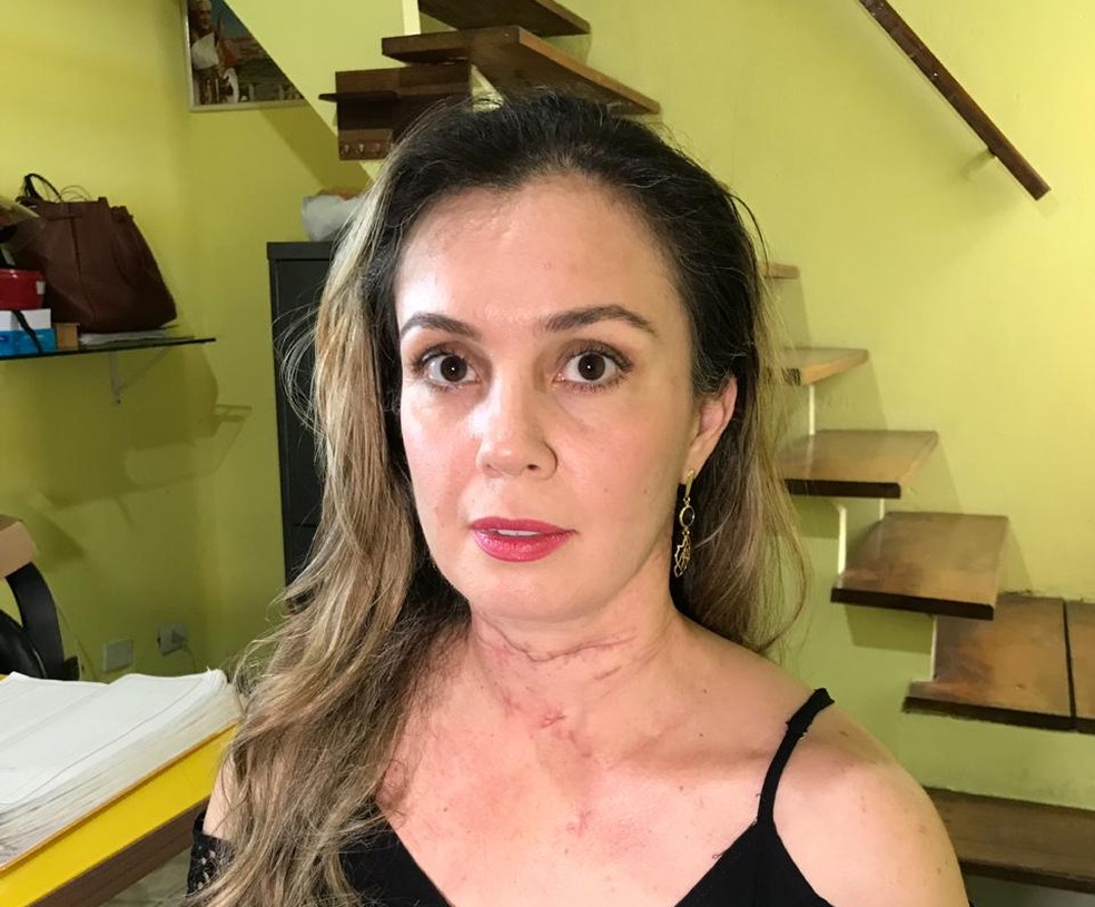 Vendedora Aline Guimar&atilde;es foi esfaqueada mais de 70 vezes pelo ex-companheiro &mdash; Foto: Talita Fran&ccedil;a/ TV Vanguarda