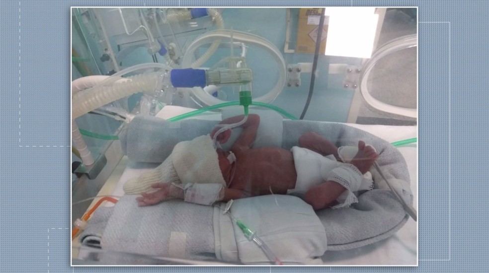 Maria Alice e Maria VitÃ³ria nasceram prematuras, segundo a mÃ£e das gÃªmeas â Foto: Arquivo/RPC