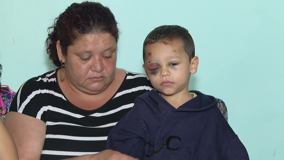 À esquerda, Rosilda de Brito, mãe de João Miguel (à direita), de três anos, machucado após cair em academia comunitária do DF — Foto: TV Globo/Reprodução