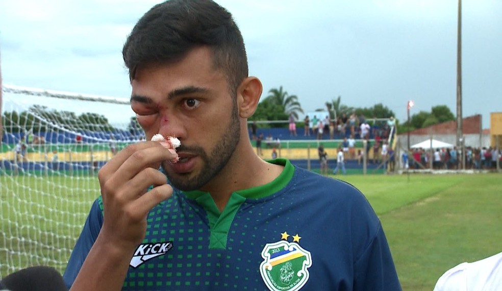 ApÃ³s chute no rosto, Humberto relata ter "apagado" em campo â€” Foto: Pablo Silva/TV Clube