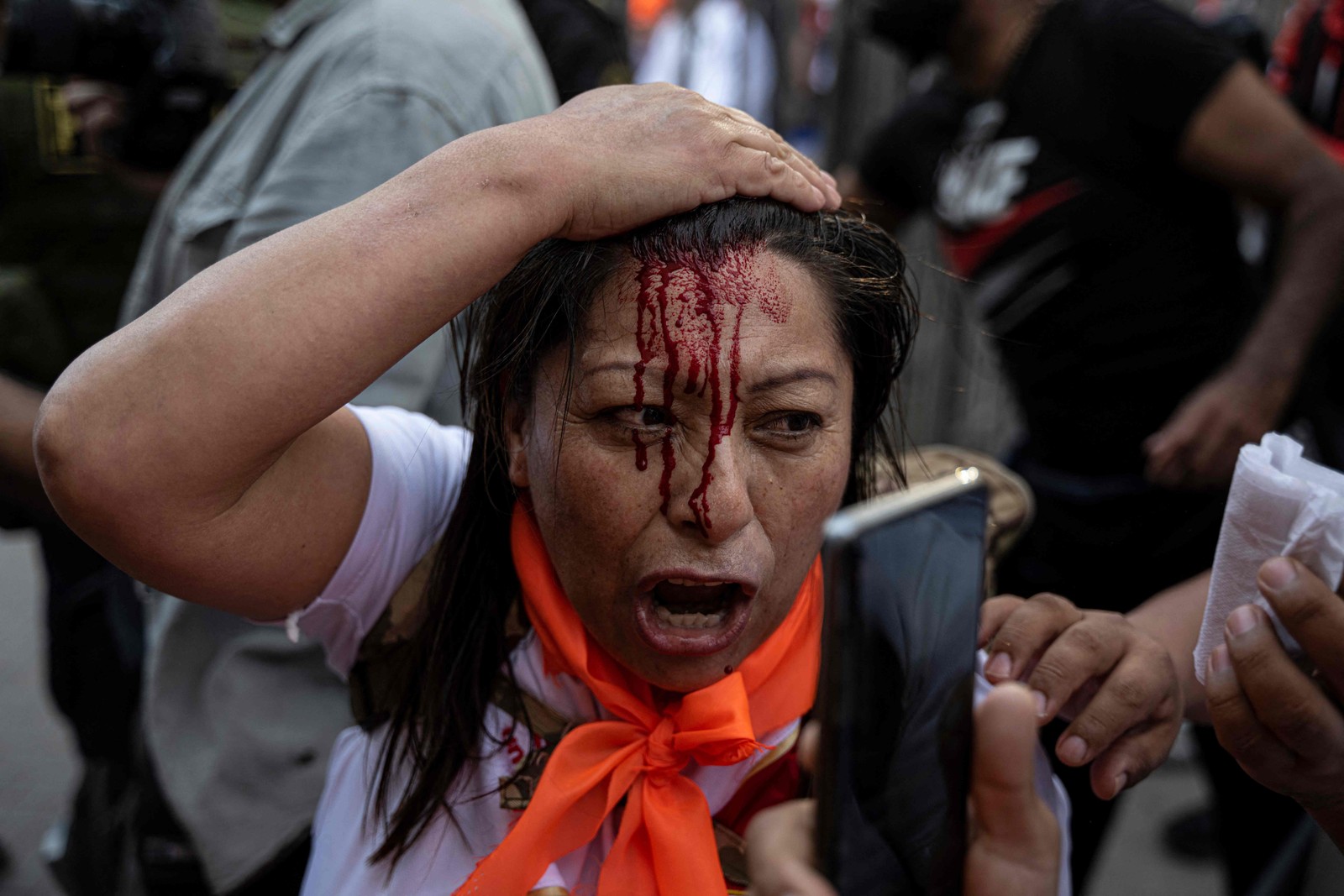 Manifestante é ferida durante protesto contra governo do presidente peruano Pedro Castillo, em Lima, em 20 de novembro de 2022.  — Foto: Ernesto BENAVIDES / AFP
