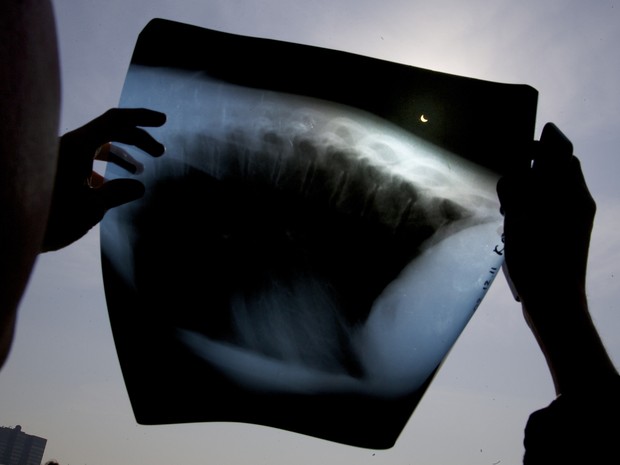 Em Moscou, na Rússia, algumas pessoas usaram exames de raio X para visualizar melhor o eclipse total do Sol (Foto: Ivan Sekretarev/AP)